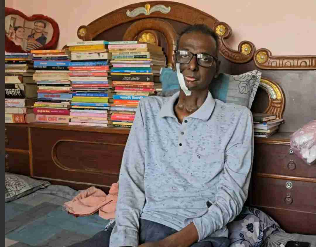 साहित्यकार अशोक दत्तको उपचार सहयोगार्थ चैत २१ मा सांगीतिक च्यारिटी कार्यक्रम